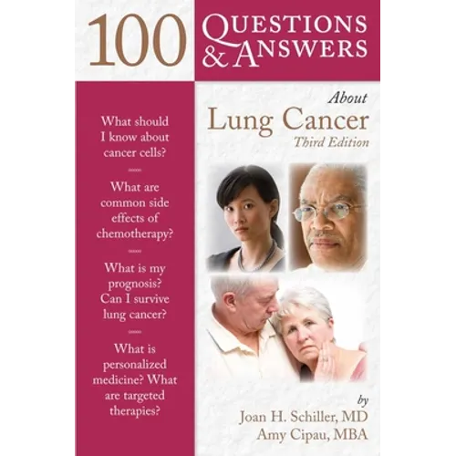 100 Questions & Answers about Lung Cancer