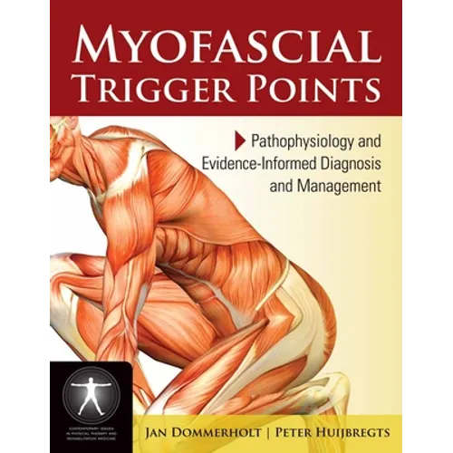 Myofascial Trigger Points: Pathophysiology and Evidence-Informed Diagnosis and Management: Pathophysiology and Evidence-Informed Diagnosis and Managem
