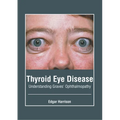 Thyroid Eye Disease: Understanding Graves' Ophthalmopathy