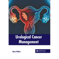Urological Cancer Management