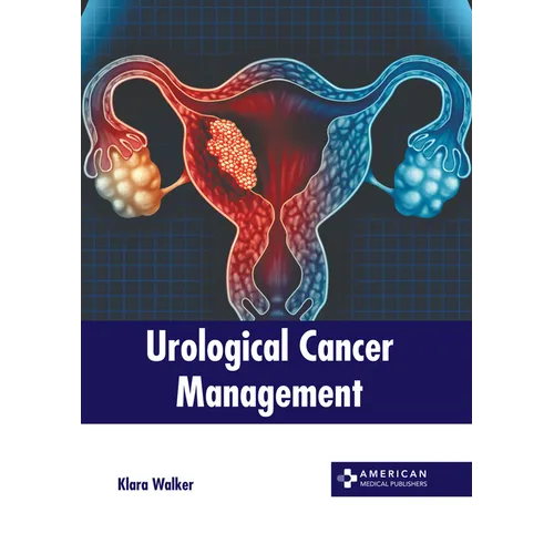 Urological Cancer Management