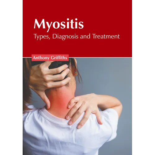 Myositis: Types, Diagnosis and Treatment