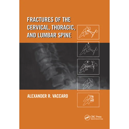 Fractures of the Cervical, Thoracic, and Lumbar Spine