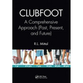 Clubfoot: A Comprehensive Approach (Past, Present, and Future)