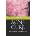 Acne Cure: Best Guide To Cure Acne Fast
