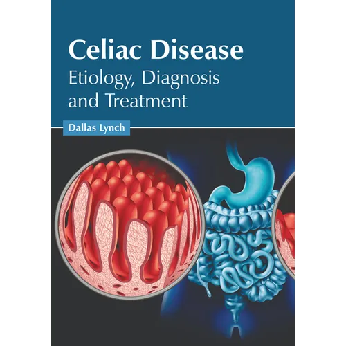 Celiac Disease: Etiology, Diagnosis and Treatment