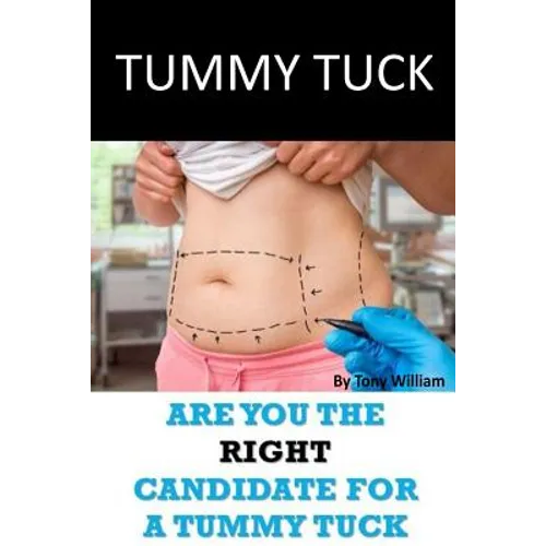 Tummy Tuck: Are You The Right Candidate For A Tummy Tuck