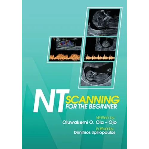 NT Scanning for the Beginner