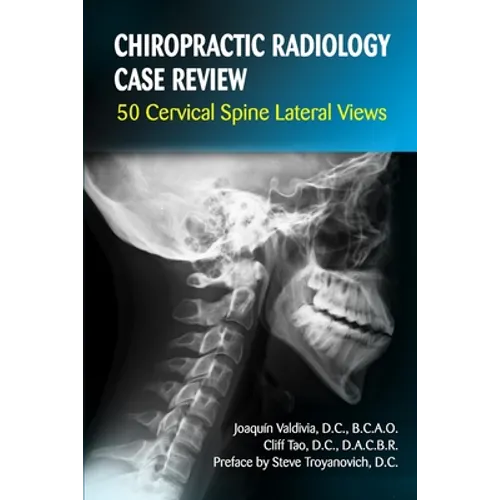 Chiropractic Radiology Case Review: 50 Cervical Spine Lateral Views