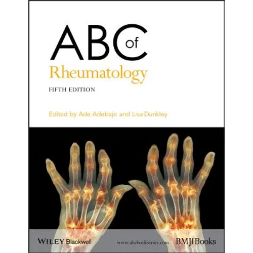 ABC of Rheumatology