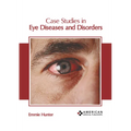 Case Studies in Eye Diseases and Disorders