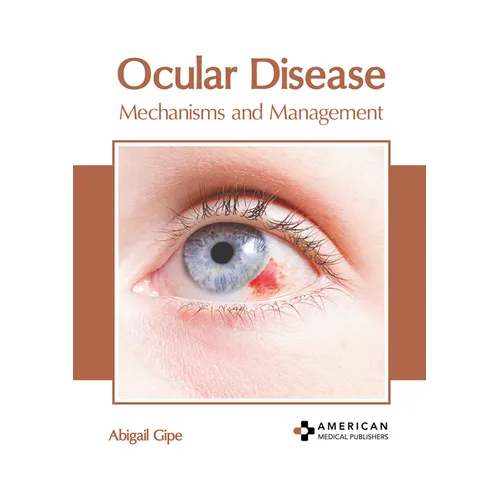 Ocular Disease: Mechanisms and Management