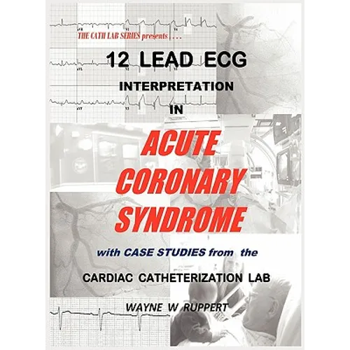 12 Lead ECG Interpretation in Acute Coronary Syndrome with Case Studies from the Cardiac Catheterization Lab