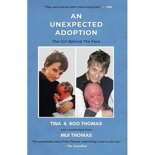 An Unexpected Adoption: The Girl Behind The Face