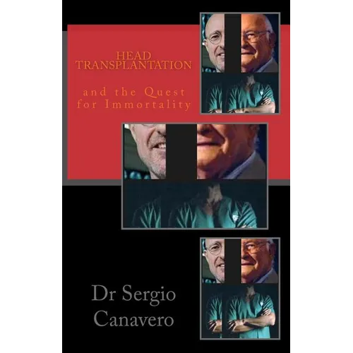 Head Transplantation: and the QUEST for IMMORTALITY