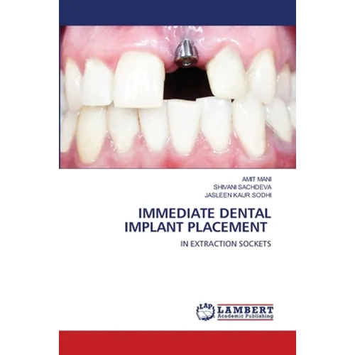 Immediate Dental Implant Placement - Paperback