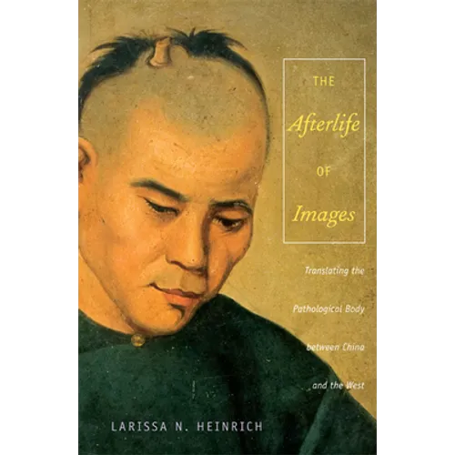 The Afterlife of Images: Translating the Pathological Body between China and the West