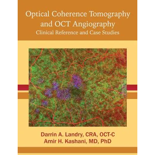 Optical Coherence Tomography and OCT Angiography: Clinical Reference and Case Studies