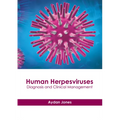 Human Herpesviruses: Diagnosis and Clinical Management