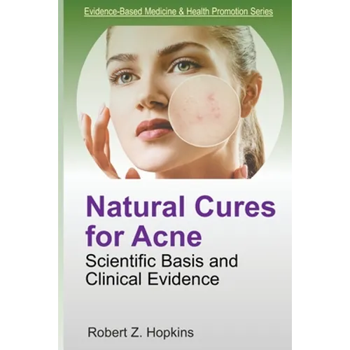 Natural Cures for Acne: Scientific Basis and Clinical Evidence