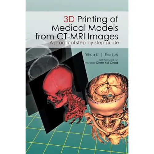 3D Printing of Medical Models from CT-MRI Images: A Practical step-by-step guide