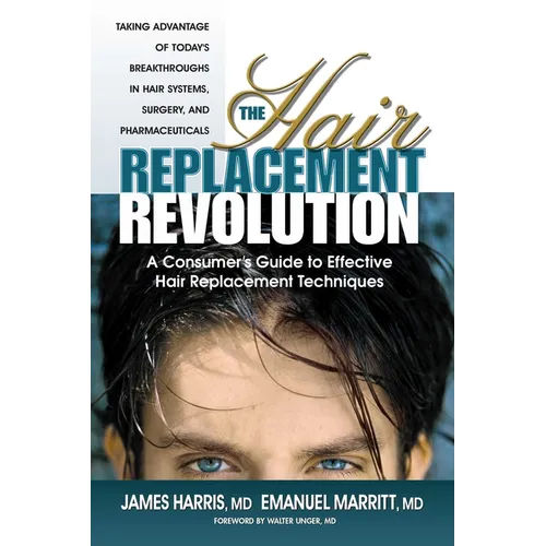 The Hair Replacement Revolution