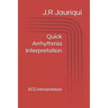 Quick Arrhythmia Interpretation: ECG interpretation