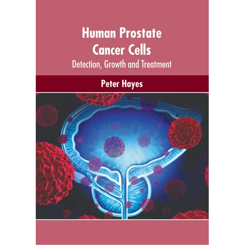 Human Prostate Cancer Cells: Detection, Growth and Treatment