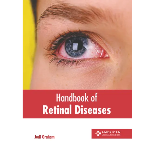 Handbook of Retinal Diseases