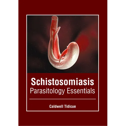 Schistosomiasis: Parasitology Essentials