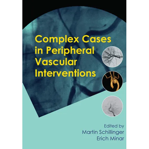 Complex Cases in Peripheral Vascular Interventions