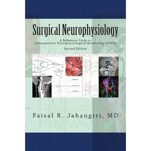 Surgical Neurophysiology - 2nd Edition: A Reference Guide to Intraoperative Neurophysiological Monitoring
