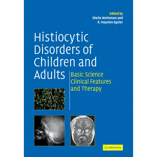 Histiocytic Disorders of Children and Adults: Basic Science, Clinical Features and Therapy