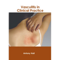 Vasculitis in Clinical Practice