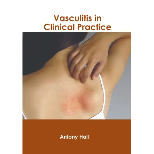 Vasculitis in Clinical Practice