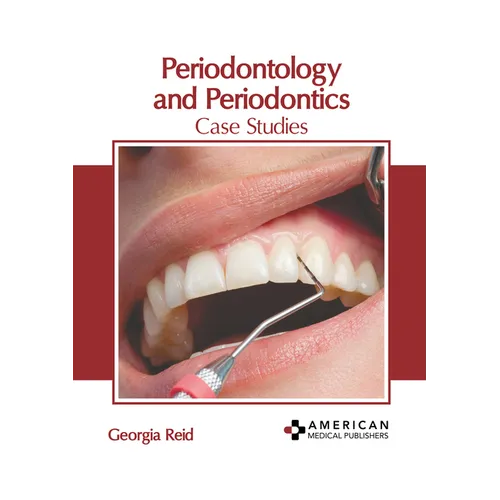 Periodontology and Periodontics: Case Studies