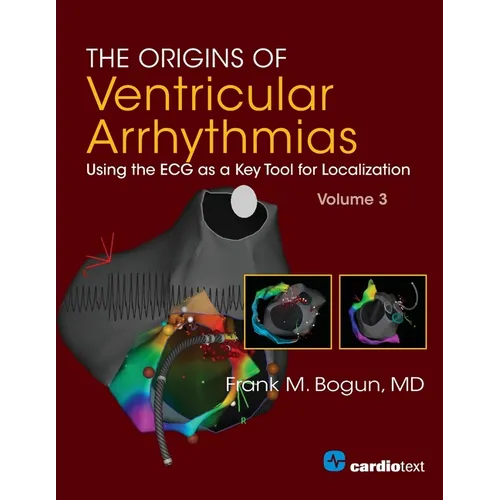 The Origins of Ventricular Arrhythmias: Using the ECG as a Key Tool for Localization, Volume 3