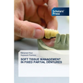 Soft Tissue Management in Fixed Partial Dentures