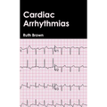 Cardiac Arrhythmias