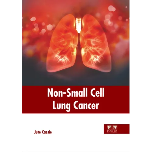 Non-Small Cell Lung Cancer