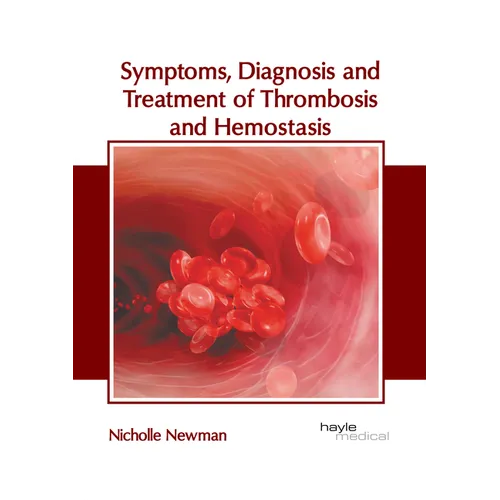 Symptoms, Diagnosis and Treatment of Thrombosis and Hemostasis