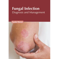 Fungal Infection: Diagnosis and Management