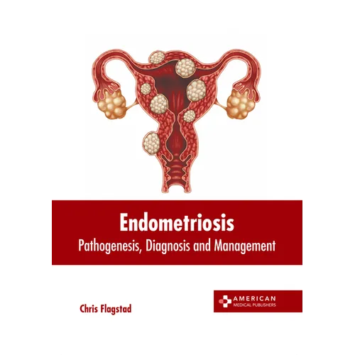 Endometriosis: Pathogenesis, Diagnosis and Management